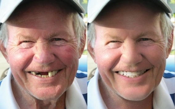 Fotki przed i po retuszu