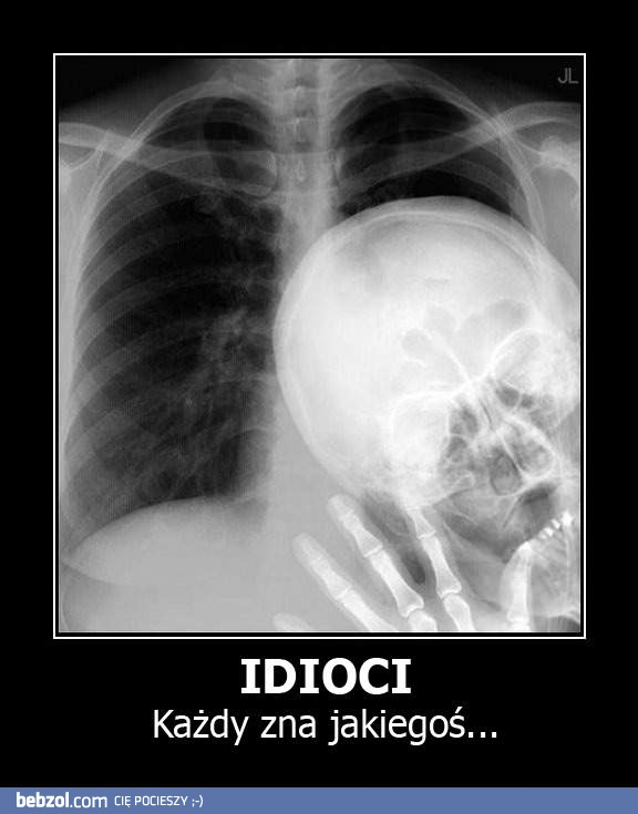 Idioci