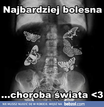 Najbardziej bolesna choroba świata