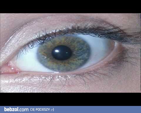 heterochromia centralna  ♥