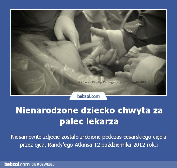 Nienarodzone dziecko chwyta za palec lekarza