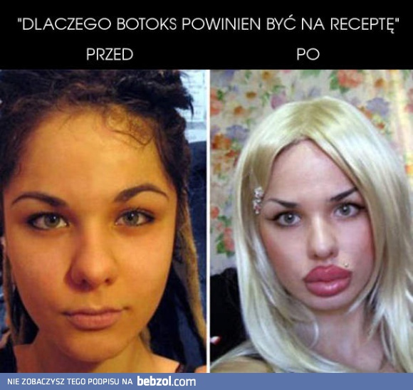 Botoks - powinni tego zabronić