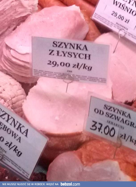 Jesteś łysy? Uważaj na siebie