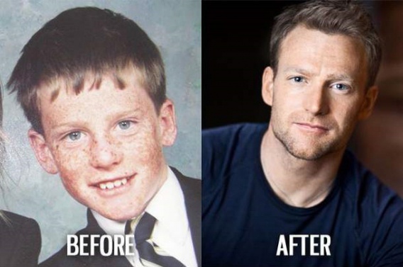 Byłeś brzydkim dzieckiem? Nic straconego (15 zdjęć)