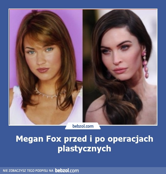 Megan Fox przed i po operacjach plastycznych