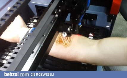 Laserowa skaryfikacja logo NHL na przedramieniu