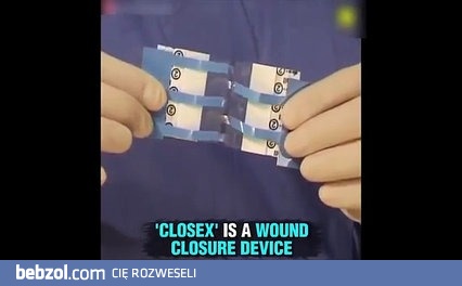 Szwy chirurgiczne przyszłości 