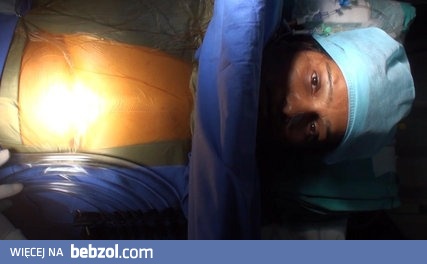 NIETYPOWA OPERACJA SERCA 