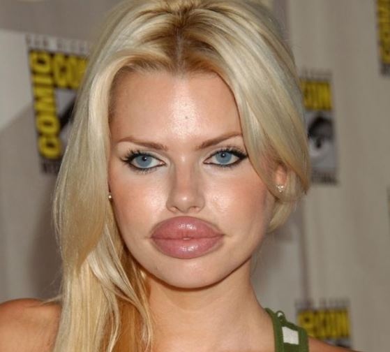 Osoby, których operacje plastyczne nieco wymknęły się spod kontroli.