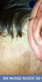 Chyba mam coś w uchu