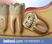 Pieprzyć ząb mądrości..