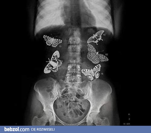 Motylki w brzuchu - MIŁOŚĆ