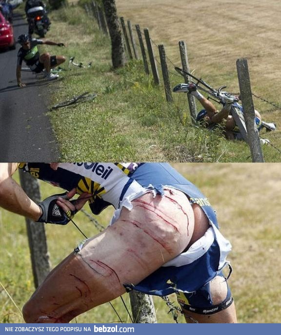 Upss - to musiało boleć..