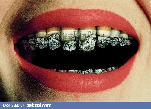 Smoking kills your teeth