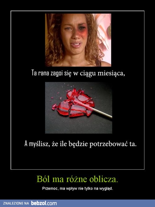 Ból ma różne oblicza
