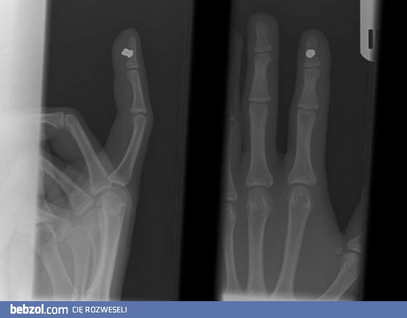 Piłeś? Nie baw się wiatrówką...