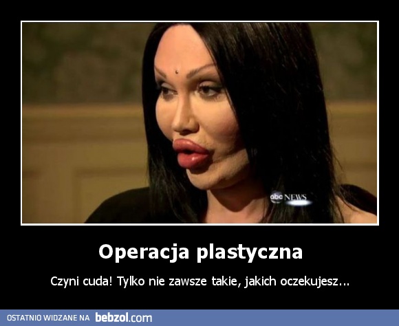 Operacja Plastyczna | Bebzol.com