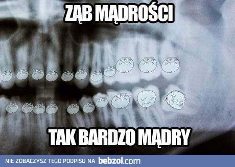 Ząb mądrości