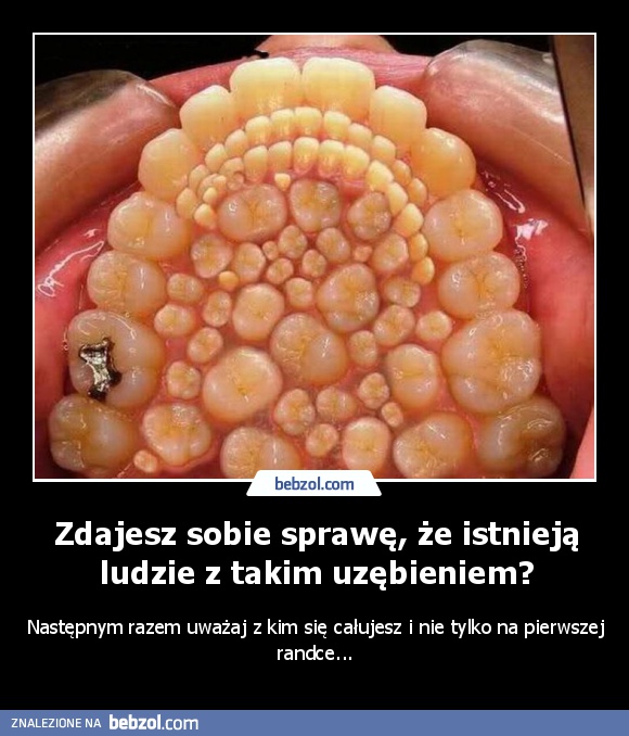 Zdajesz sobie sprawę, że istnieją ludzie z takim uzębieniem?