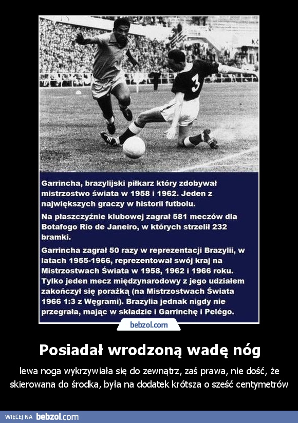 Posiadał wrodzoną wadę nóg