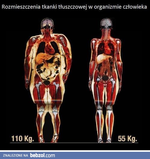 Rozmieszczenie tkanki tłuszczowej w organizmie