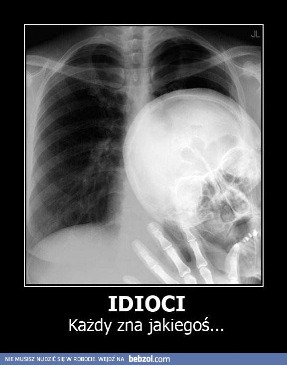 Idioci