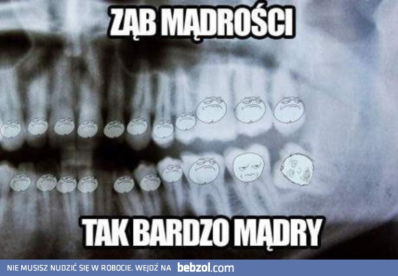 Ząb mądrości