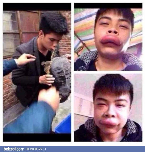 Ugryzienie przez żółwia