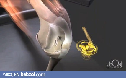 Jak naprawić zepsutego człowieka?