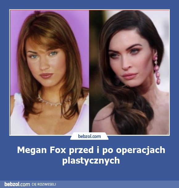 Megan Fox przed i po operacjach plastycznych